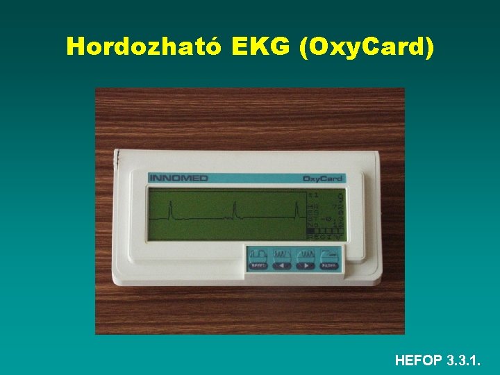 Hordozható EKG (Oxy. Card) HEFOP 3. 3. 1. 