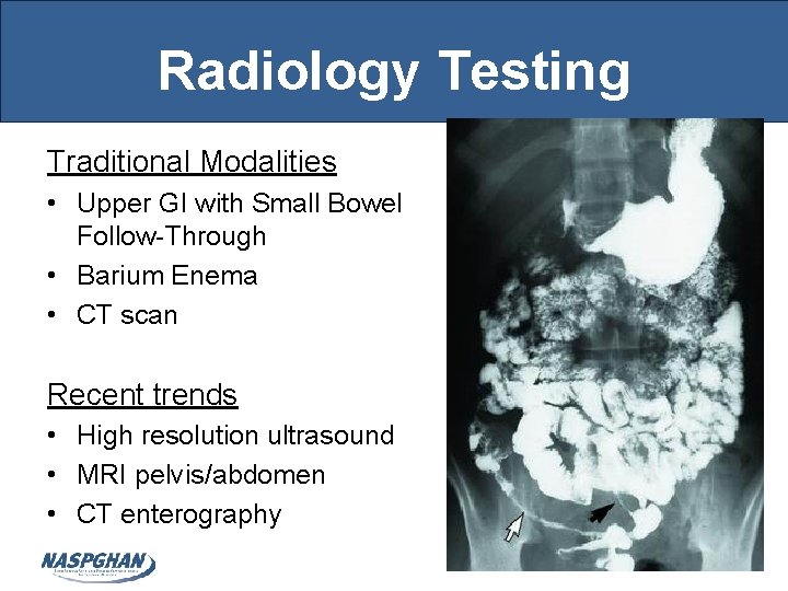 Radiology Testing Traditional Modalities • Upper GI with Small Bowel Follow-Through • Barium Enema