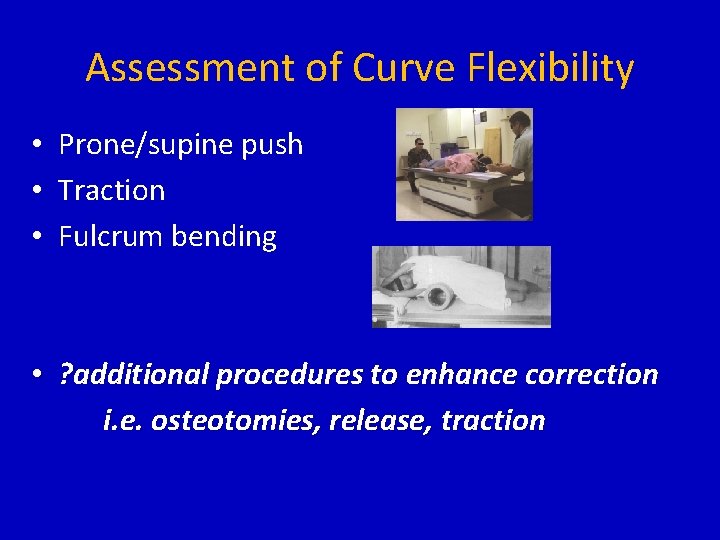 Assessment of Curve Flexibility • Prone/supine push • Traction • Fulcrum bending • ?