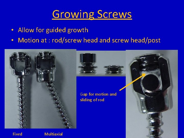 Growing Screws • Allow for guided growth • Motion at : rod/screw head and