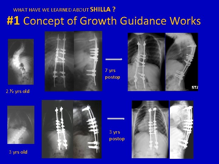 WHAT HAVE WE LEARNED ABOUT SHILLA ? #1 Concept of Growth Guidance Works 7