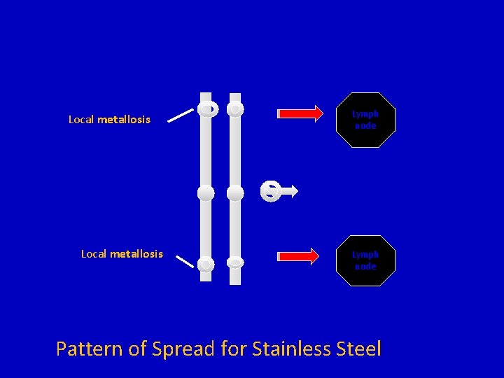 Local metallosis Lymph node Pattern of Spread for Stainless Steel 