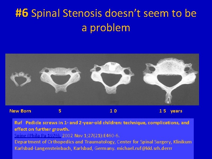 #6 Spinal Stenosis doesn’t seem to be a problem New Born 5 10 1