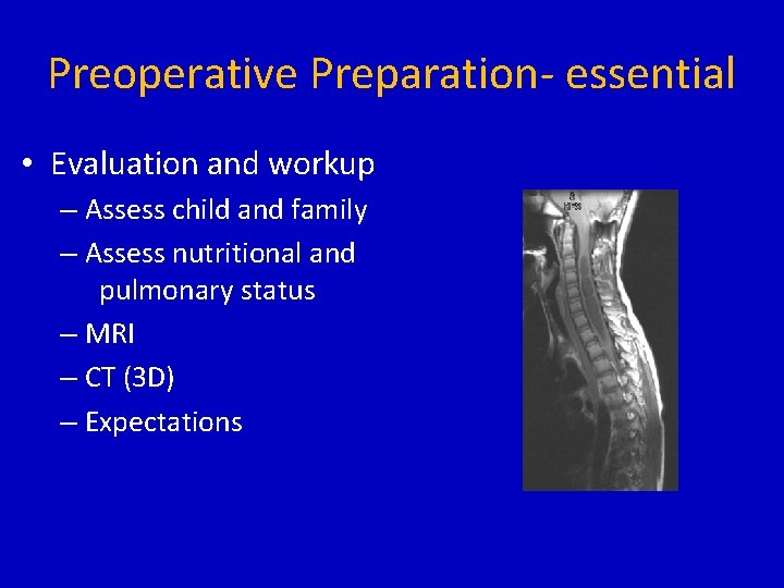 Preoperative Preparation- essential • Evaluation and workup – Assess child and family – Assess