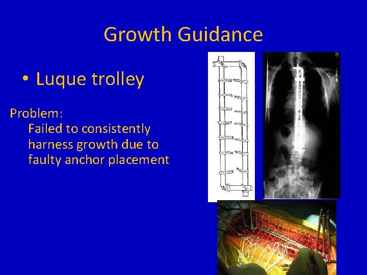 Growth Guidance • Luque trolley Problem: Failed to consistently harness growth due to faulty