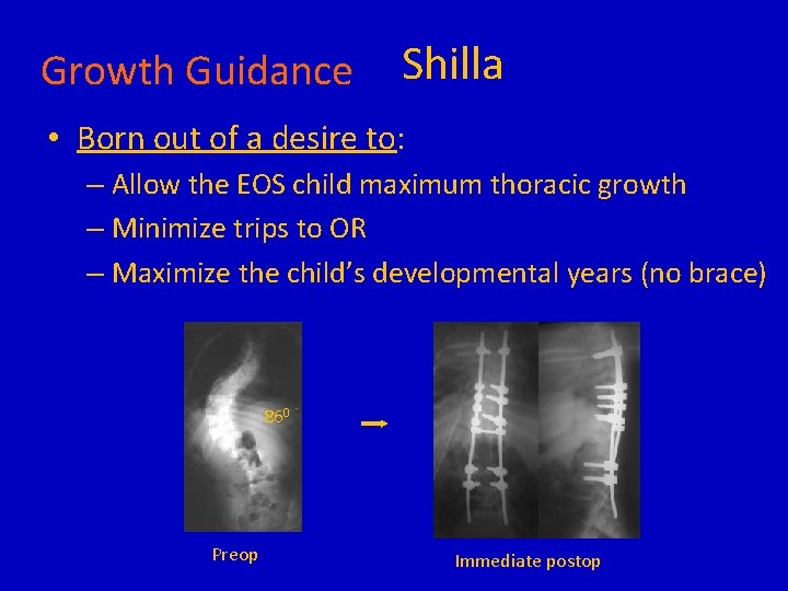 Growth Guidance Shilla • Born out of a desire to: – Allow the EOS