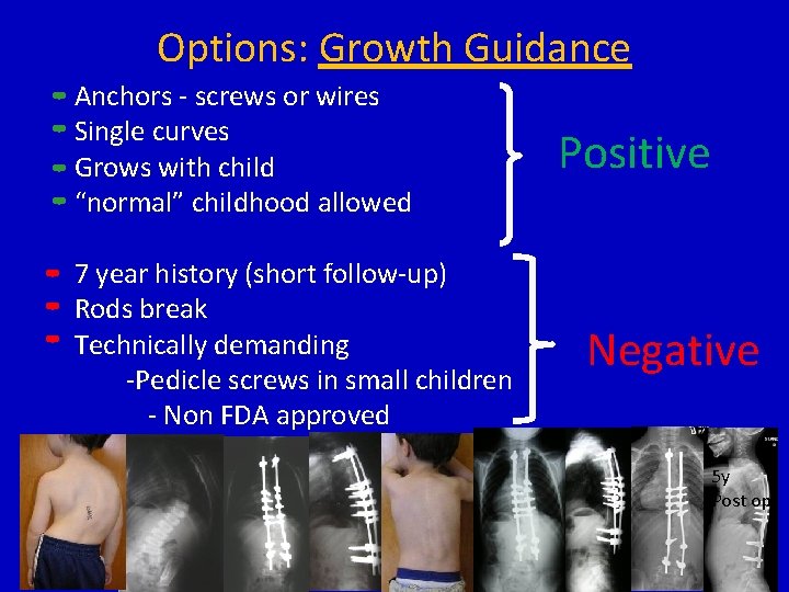 Options: Growth Guidance Anchors - screws or wires Single curves Grows with child “normal”