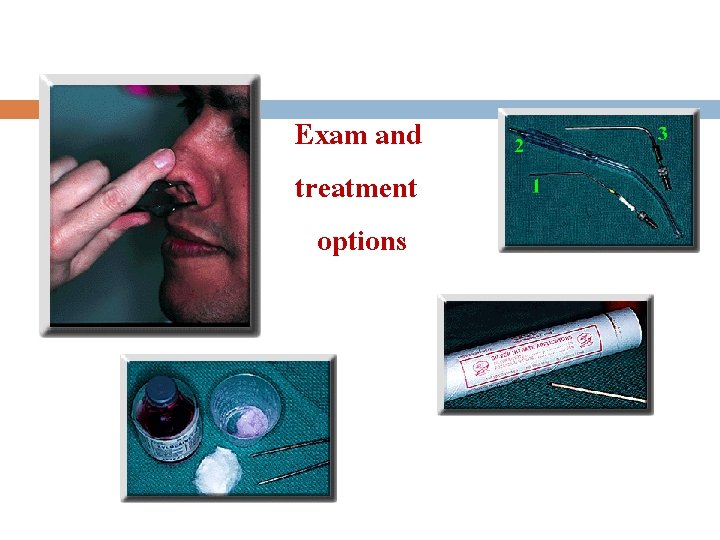 Exam and treatment options 