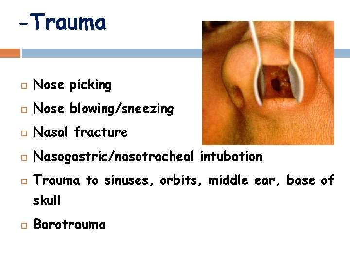 -Trauma Nose picking Nose blowing/sneezing Nasal fracture Nasogastric/nasotracheal intubation Trauma to sinuses, orbits, middle