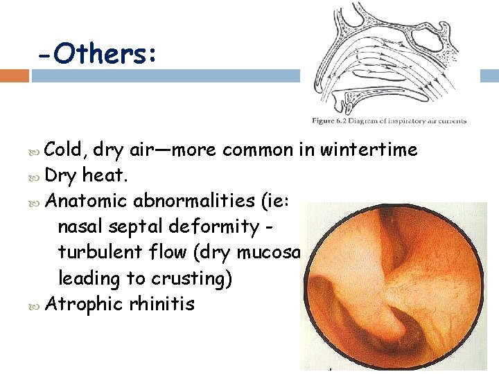 -Others: Cold, dry air—more common in wintertime Dry heat. Anatomic abnormalities (ie: nasal septal