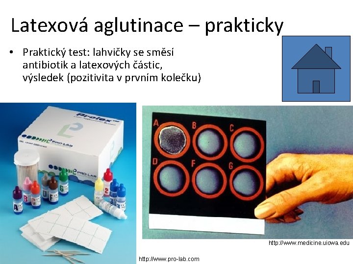 Latexová aglutinace – prakticky • Praktický test: lahvičky se směsí antibiotik a latexových částic,