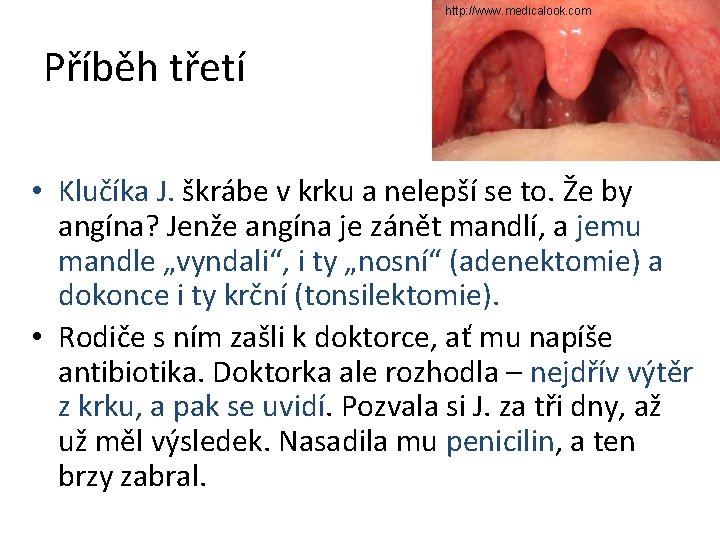 http: //www. medicalook. com Příběh třetí • Klučíka J. škrábe v krku a nelepší