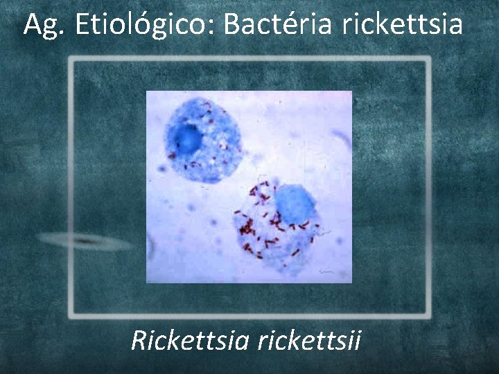 Ag. Etiológico: Bactéria rickettsia Rickettsia rickettsii Ag. Etiológico: Bactéria rickettsia Rickettsia rickettsii