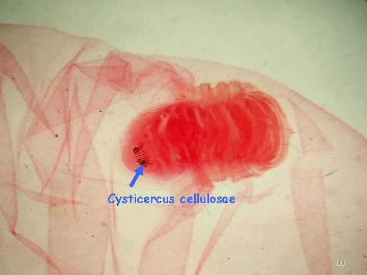 Cysticercus cellulosae 68 