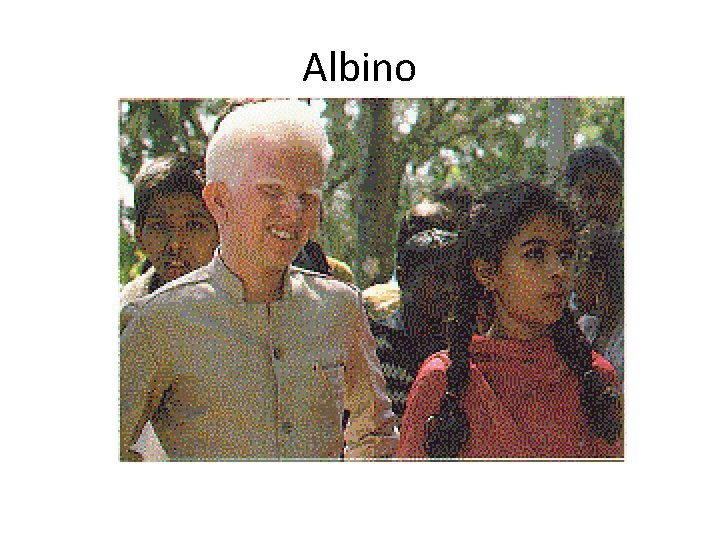 Albino 