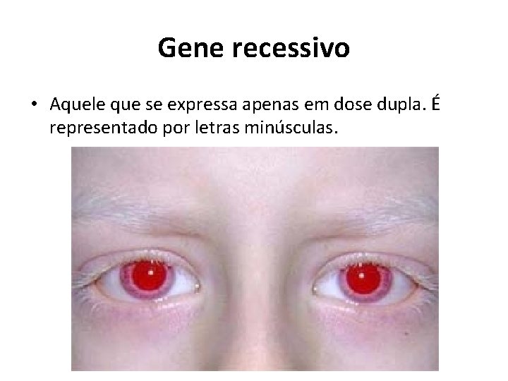 Gene recessivo • Aquele que se expressa apenas em dose dupla. É representado por
