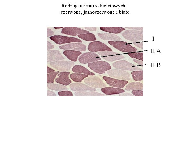 Rodzaje mięśni szkieletowych czerwone, jasnoczerwone i białe I II A II B 