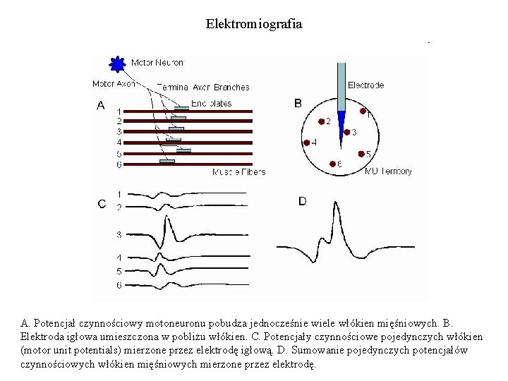 Elektromiografia A. Potencjał czynnościowy motoneuronu pobudza jednocześnie wiele włókien mięśniowych. B. Elektroda igłowa umieszczona