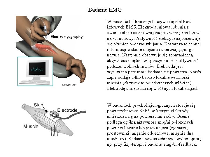 Badanie EMG W badaniach klinicznych uzywa się elektrod igłowych EMG. Elektroda igłowa lub igła