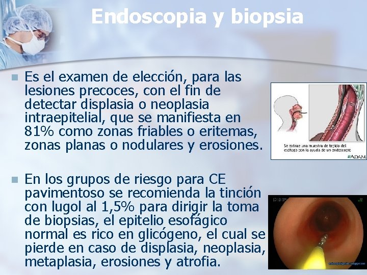 Endoscopia y biopsia n Es el examen de elección, para las lesiones precoces, con