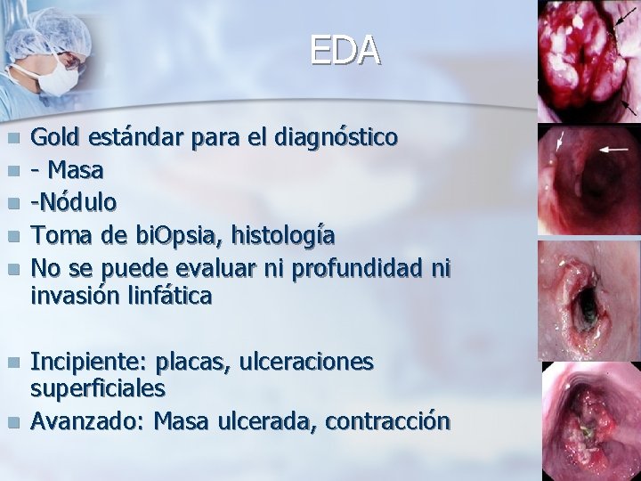 EDA n n n n Gold estándar para el diagnóstico - Masa -Nódulo Toma