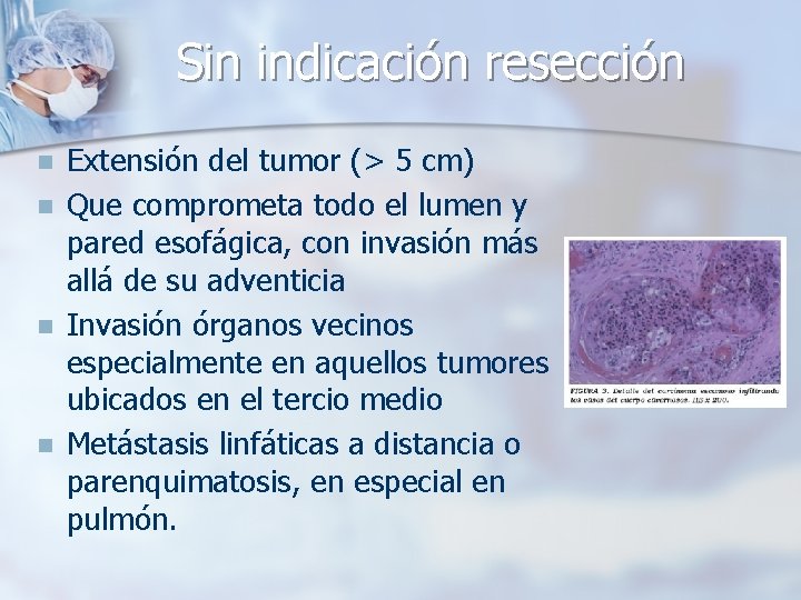 Sin indicación resección n n Extensión del tumor (> 5 cm) Que comprometa todo