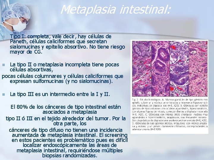 Metaplasia intestinal: n Tipo I: completa, vale decir, hay células de Paneth, células caliciformes