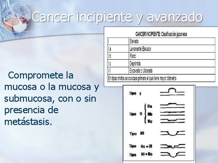 Cancer incipiente y avanzado Compromete la mucosa o la mucosa y submucosa, con o