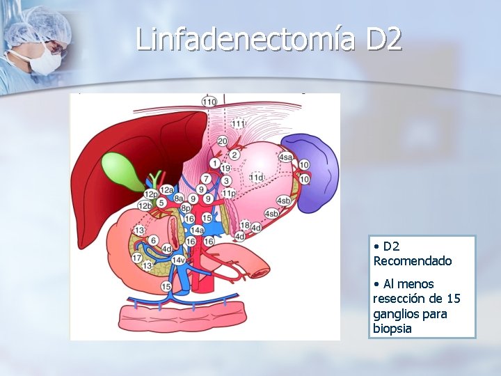Linfadenectomía D 2 • D 2 Recomendado • Al menos resección de 15 ganglios