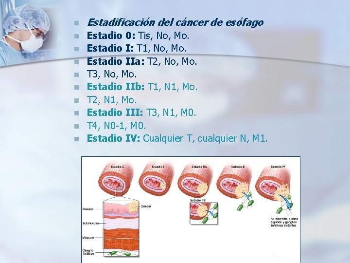 n Estadificación del cáncer de esófago n Estadio 0: Tis, No, Mo. Estadio I: