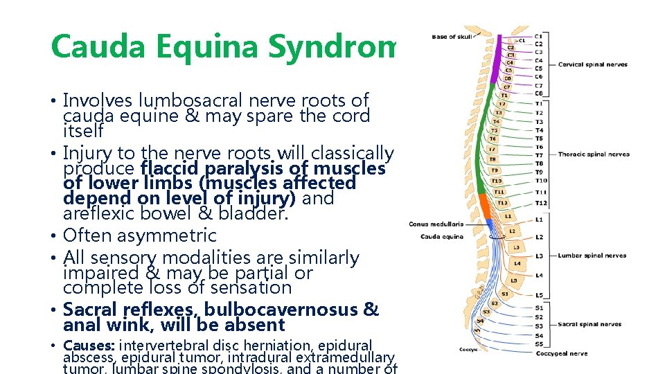 Cauda Equina Syndrome • Involves lumbosacral nerve roots of cauda equine & may spare