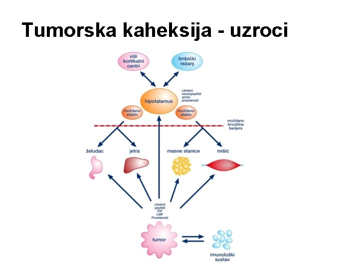 Tumorska kaheksija - uzroci 