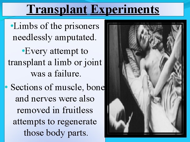 Transplant Experiments • Limbs of the prisoners needlessly amputated. • Every attempt to transplant