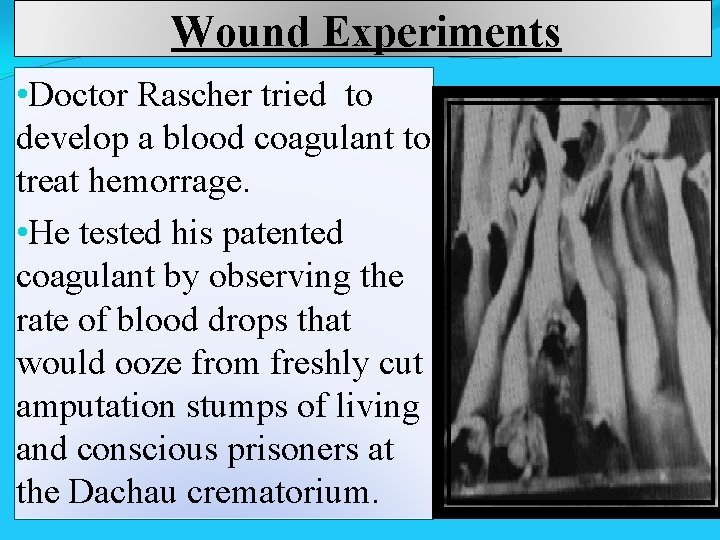  Wound Experiments • Doctor Rascher tried to develop a blood coagulant to treat