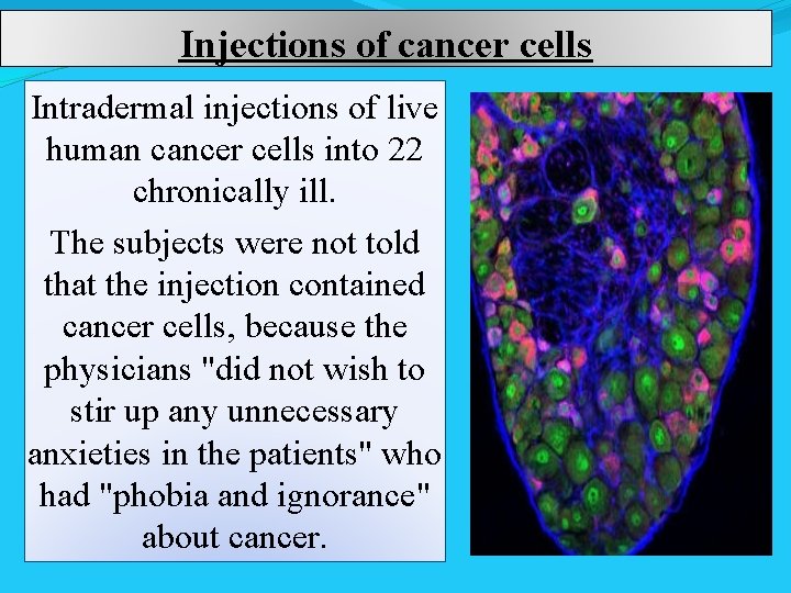 Injections of cancer cells Intradermal injections of live human cancer cells into 22 chronically
