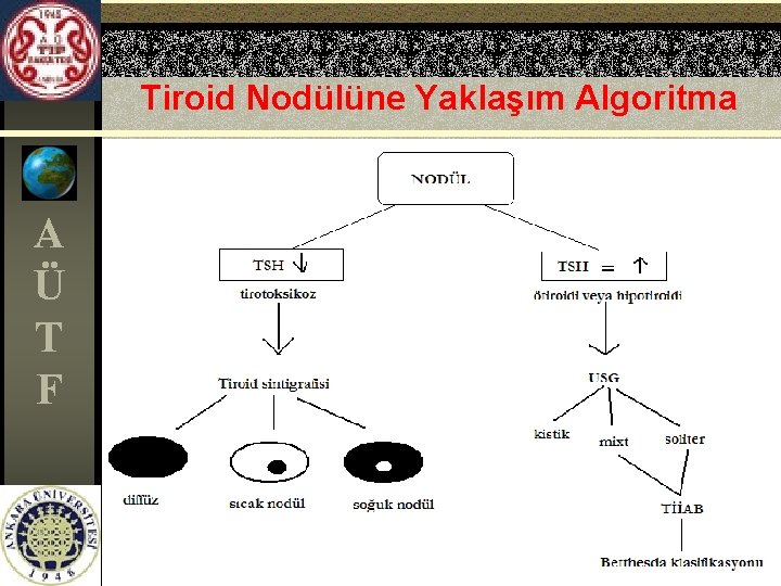 Tiroid Nodülüne Yaklaşım Algoritma A Ü T F 