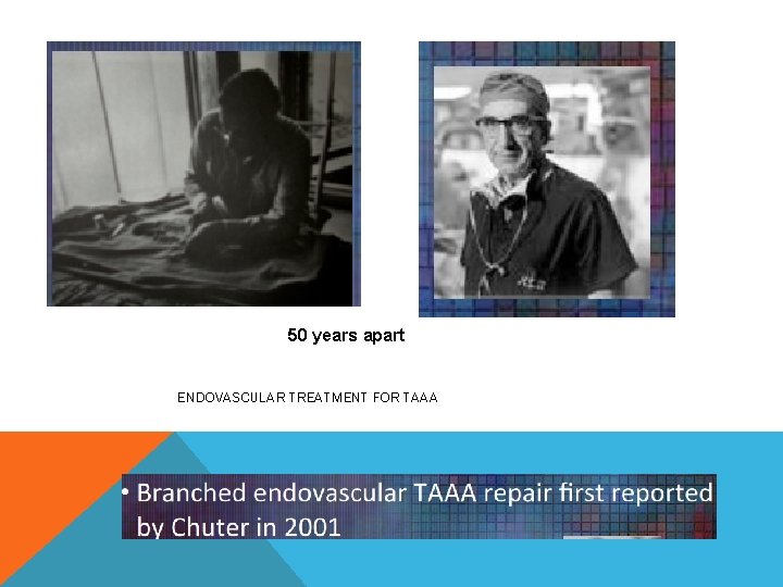 50 years apart ENDOVASCULAR TREATMENT FOR TAAA 