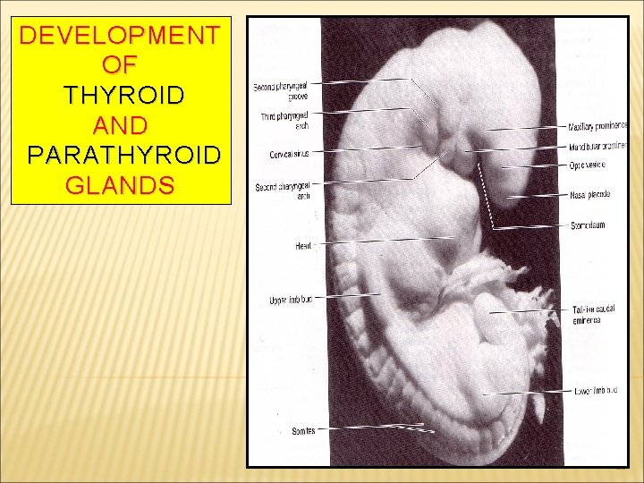 DEVELOPMENT OF THYROID AND PARATHYROID GLANDS 16 
