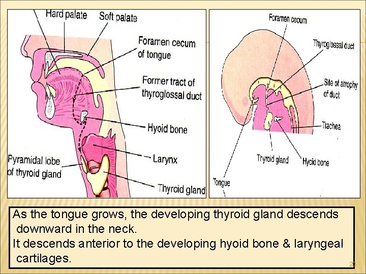 As the tongue grows, the developing thyroid gland descends downward in the neck. It