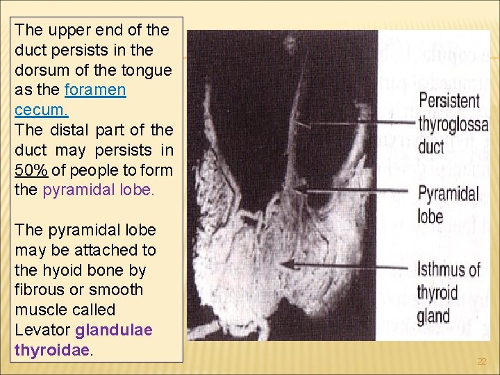 The upper end of the duct persists in the dorsum of the tongue as The upper end of the duct persists in the dorsum of the tongue as
