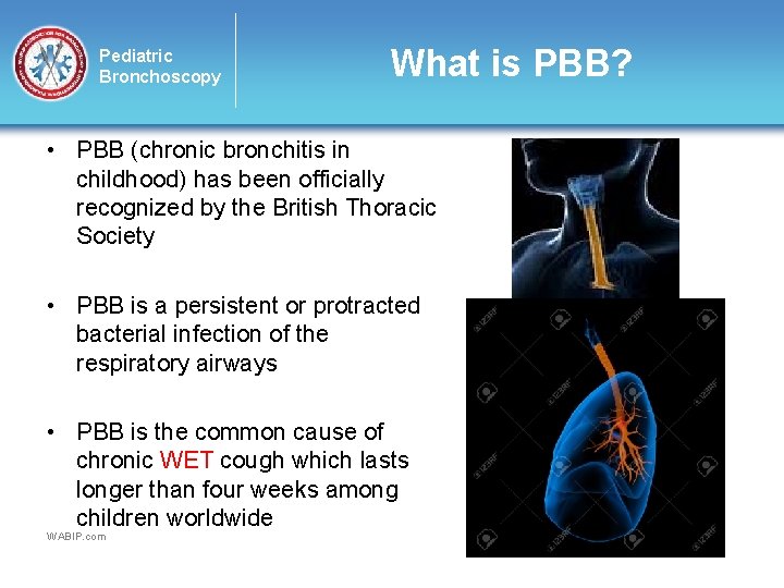 Pediatric Bronchoscopy What is PBB? • PBB (chronic bronchitis in childhood) has been officially
