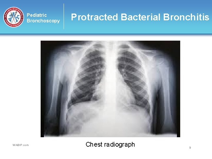 Pediatric Bronchoscopy WABIP. com Protracted Bacterial Bronchitis Chest radiograph 9 