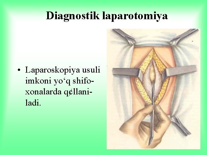 Diagnostik laparotomiya • Laparoskopiya usuli imkoni yo‘q shifoxonalarda q¢llaniladi. 