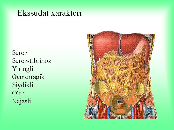 Ekssudat xarakteri Seroz-fibrinoz Yiringli Gemorragik Siydikli O‘tli Najasli 