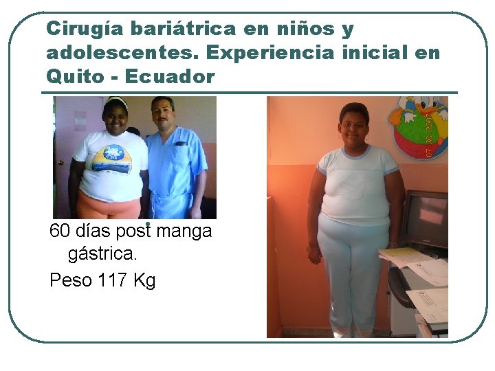 Cirugía bariátrica en niños y adolescentes. Experiencia inicial en Quito - Ecuador 60 días