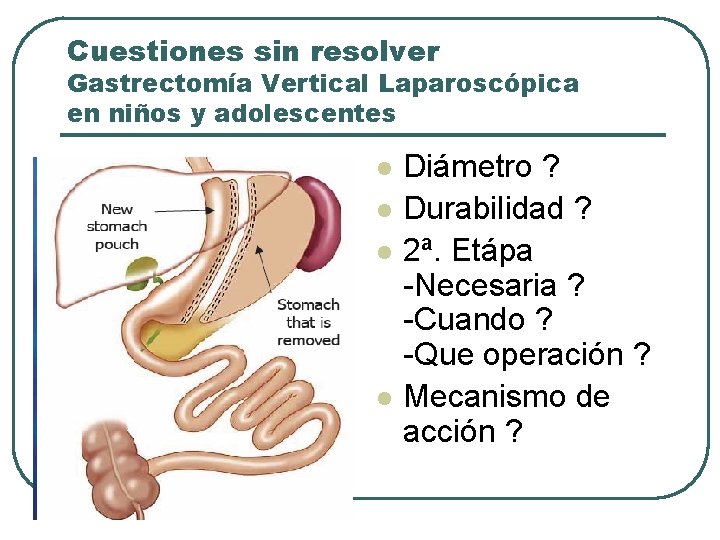 Cuestiones sin resolver Gastrectomía Vertical Laparoscópica en niños y adolescentes l l Diámetro ?