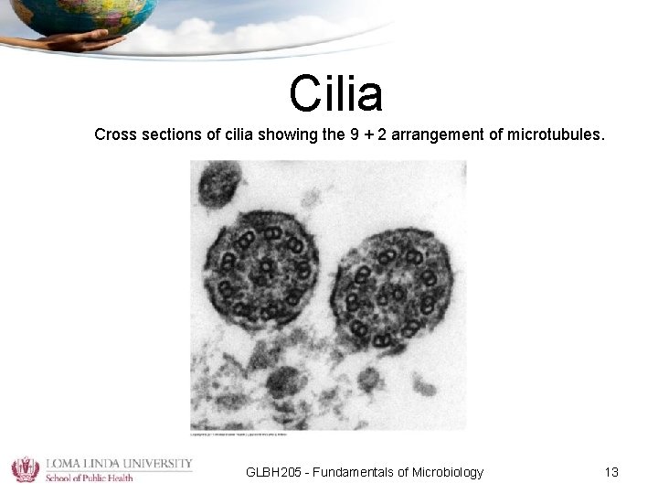 Cilia Cross sections of cilia showing the 9 + 2 arrangement of microtubules. GLBH