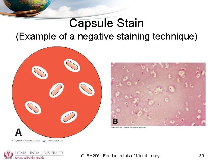 Capsule Stain (Example of a negative staining technique) GLBH 205 - Fundamentals of Microbiology