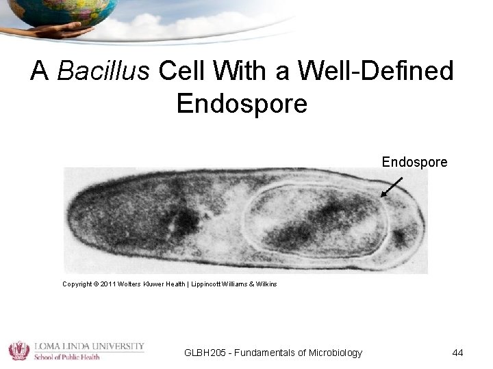 A Bacillus Cell With a Well-Defined Endospore Copyright © 2011 Wolters Kluwer Health |