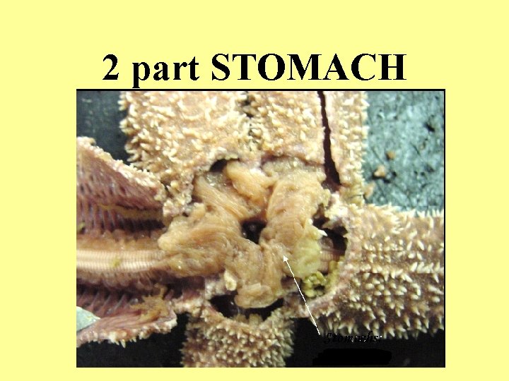 2 part STOMACH 2 part STOMACH